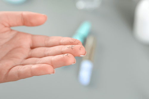 روشهای تقویت مژه 2 علت ریزش مژه