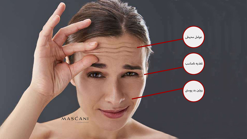 علت ایجاد چین و چروک در پوست صورت